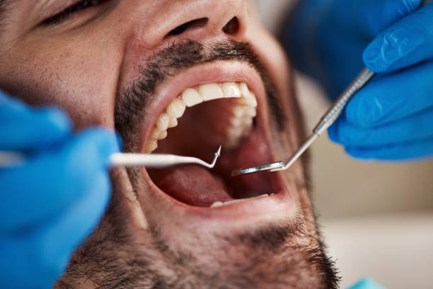 Best Emergency Tooth Extraction in Birch Run, MI